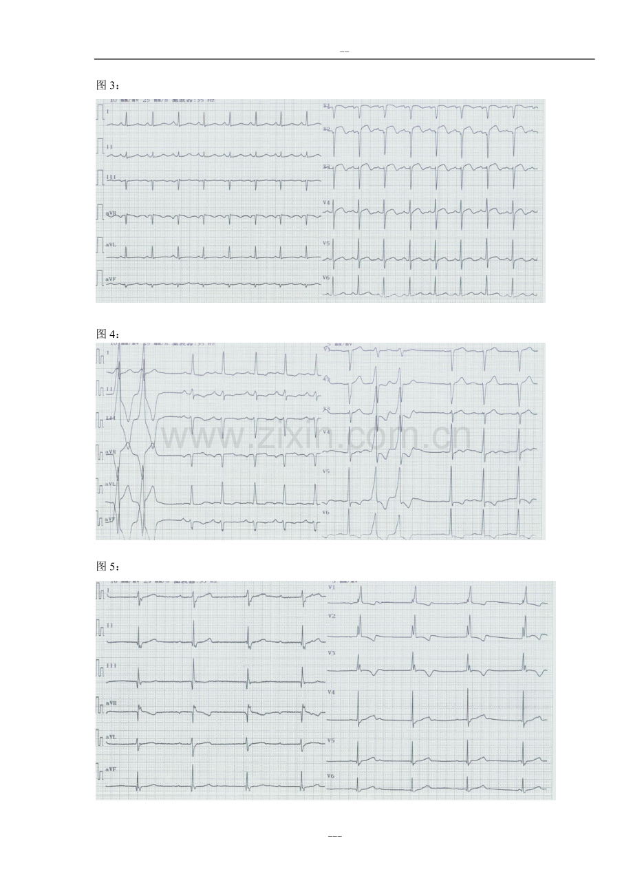 心电图试题与标准答案.doc_第2页