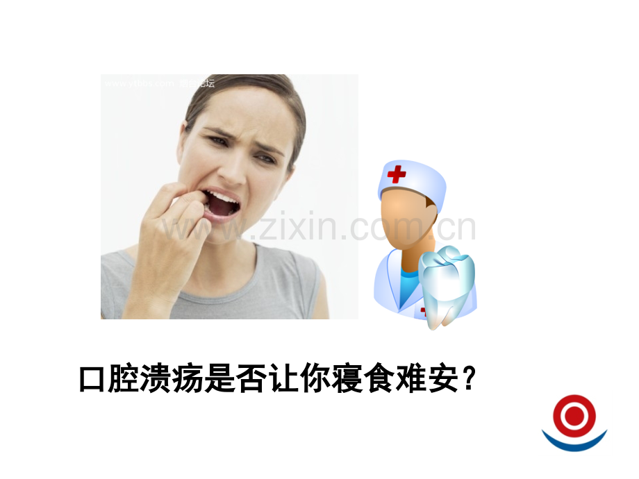 口腔溃疡用药原则.ppt_第1页