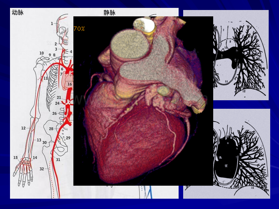 心脏及大血管影像诊断.ppt_第3页