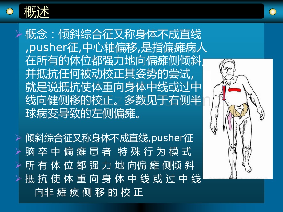 倾斜综合症.ppt_第3页