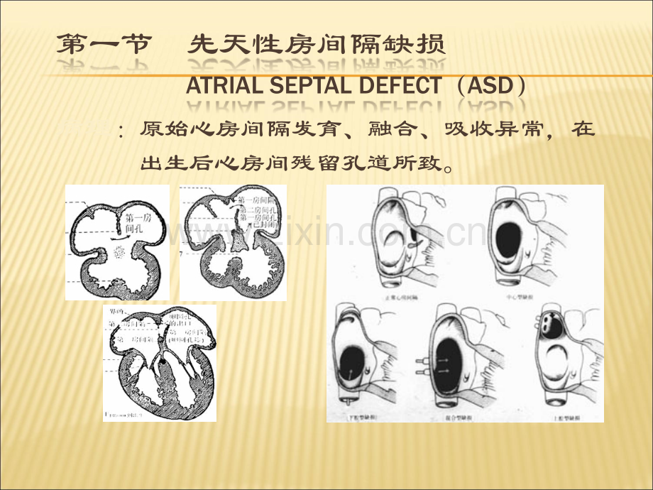 心脏及大血管影像.ppt_第3页