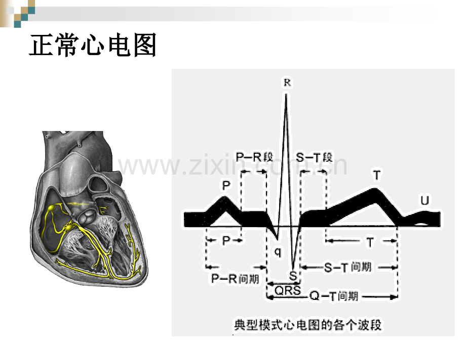 严重心律失常的急救与护理.ppt_第3页