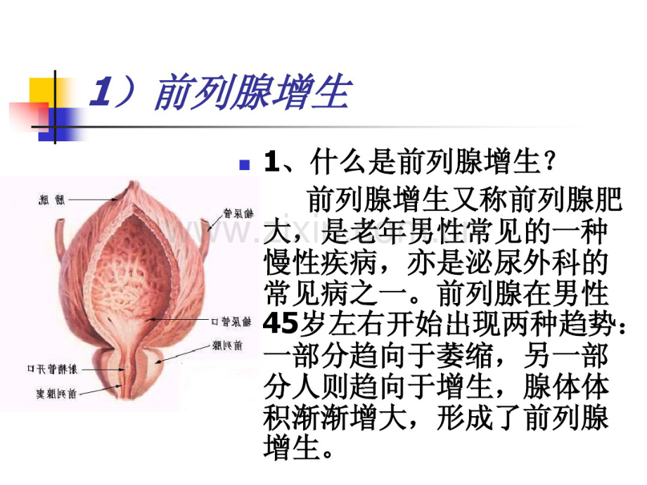 前列腺疾病知识.pdf_第2页