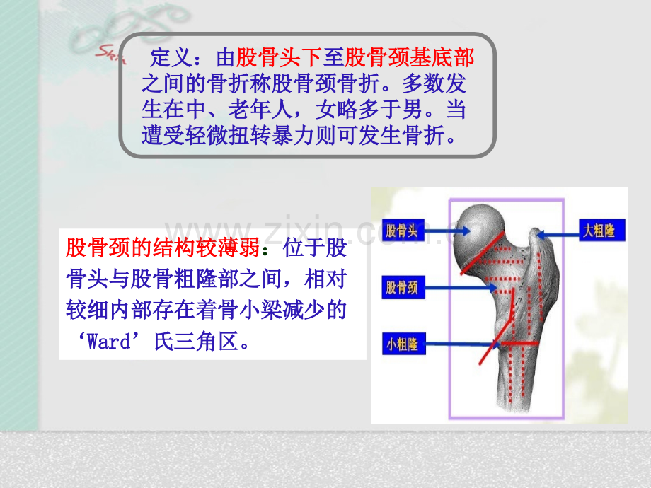 髋关节置换术后护理PPT课件.ppt_第2页