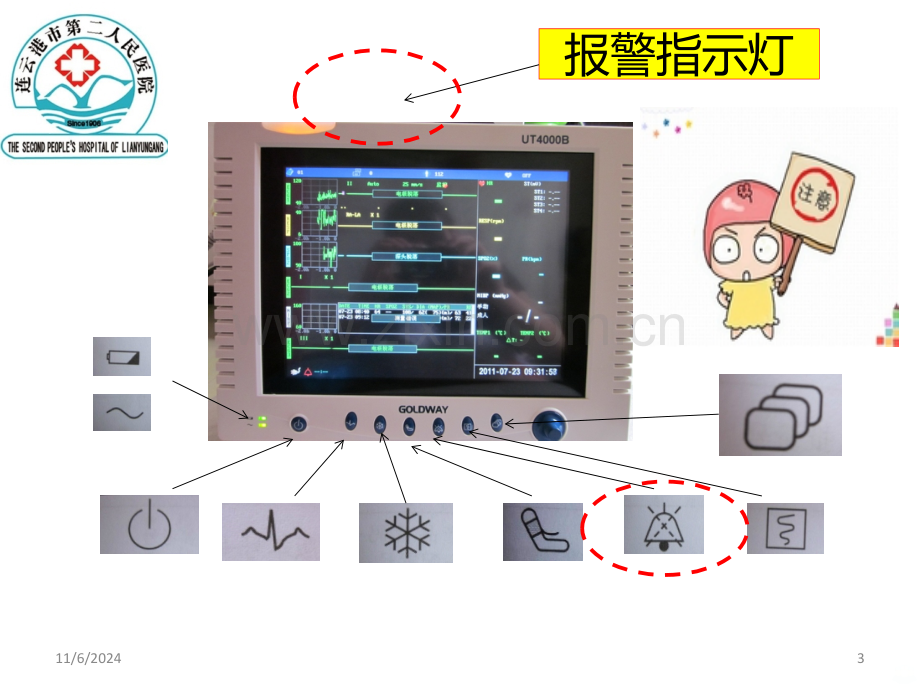 心电监护仪常见问题卞绿PPT课件.ppt_第3页