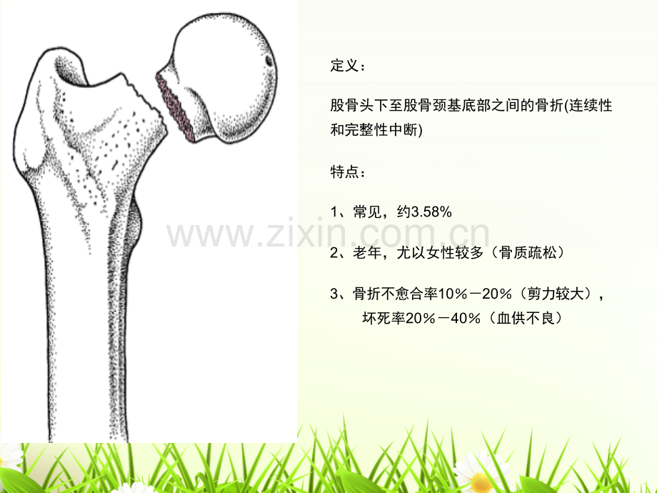 髋关节置换术病人护理查房.ppt_第3页