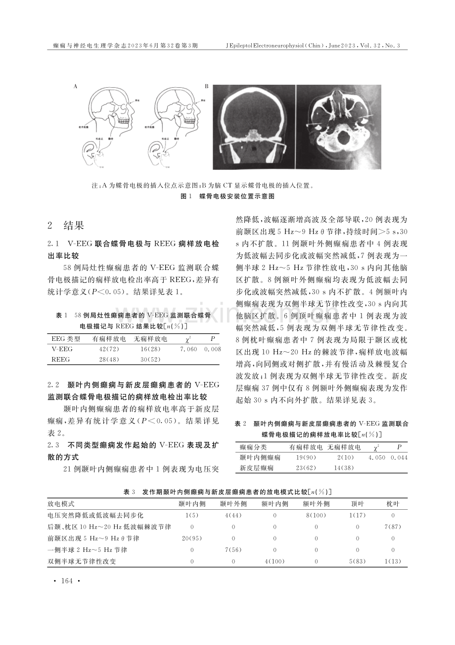 视频脑电图监测联合蝶骨电极描记对颞叶内侧癫痫及新皮层癫痫患者发作起源定位的意义.pdf_第3页