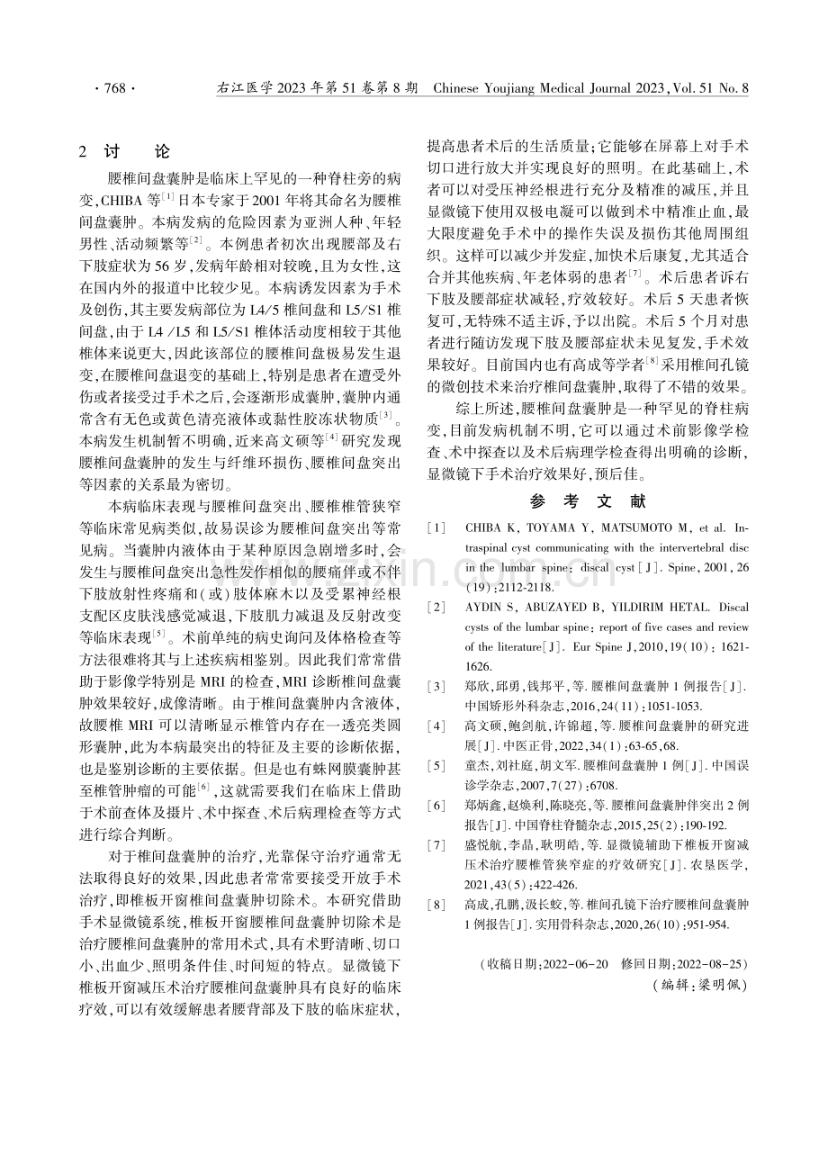 手术显微镜下治疗腰椎间盘囊肿1例报告.pdf_第2页