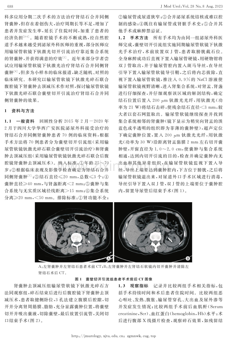 输尿管软镜钬激光碎石联合囊壁切开引流治疗肾结石合并同侧肾囊肿的临床疗效.pdf_第2页