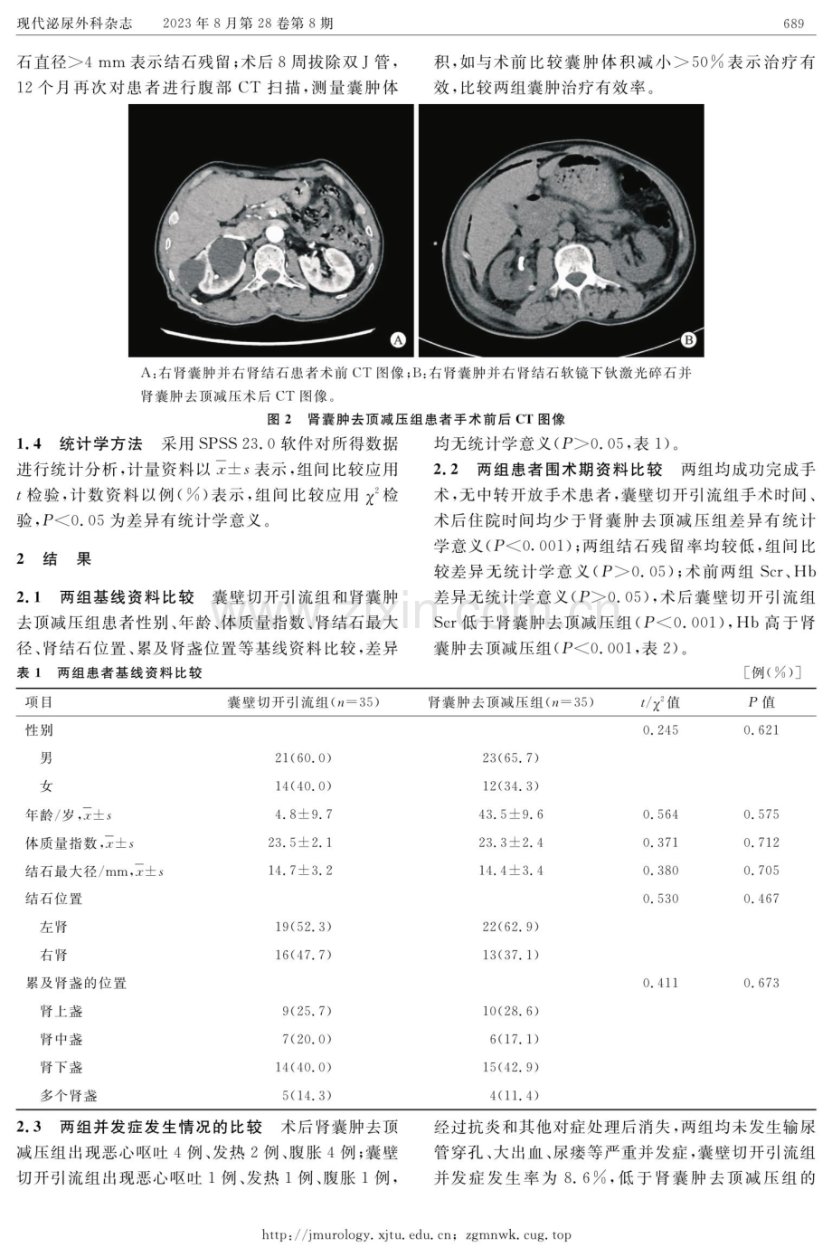 输尿管软镜钬激光碎石联合囊壁切开引流治疗肾结石合并同侧肾囊肿的临床疗效.pdf_第3页