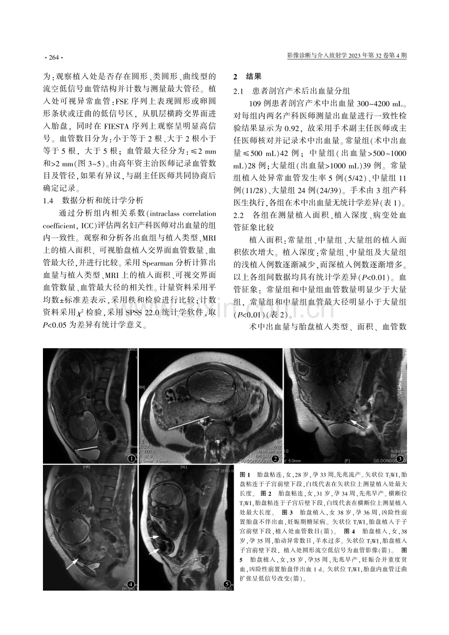 胎盘植入剖宫产术中出血量与胎盘血管的MRI分析.pdf_第3页