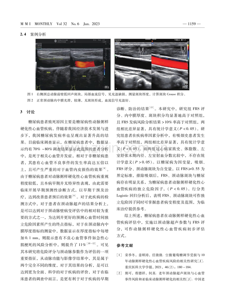 糖尿病患者颈动脉超声参数与FRS评分在动脉粥样硬化性心血管疾病评估中的价值.pdf_第3页