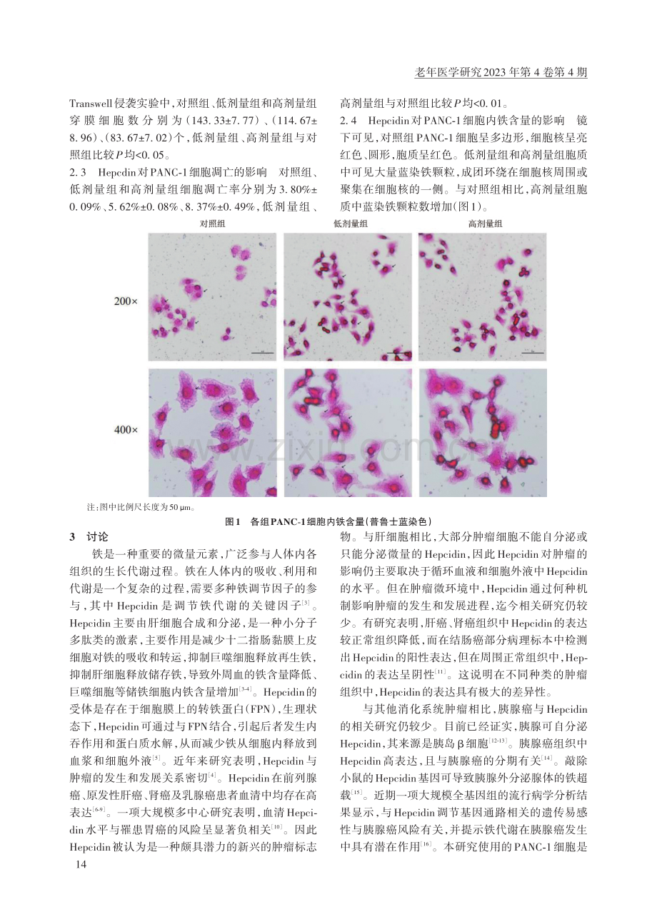 铁调素对人胰腺癌细胞增殖、迁移、侵袭和凋亡的影响.pdf_第3页