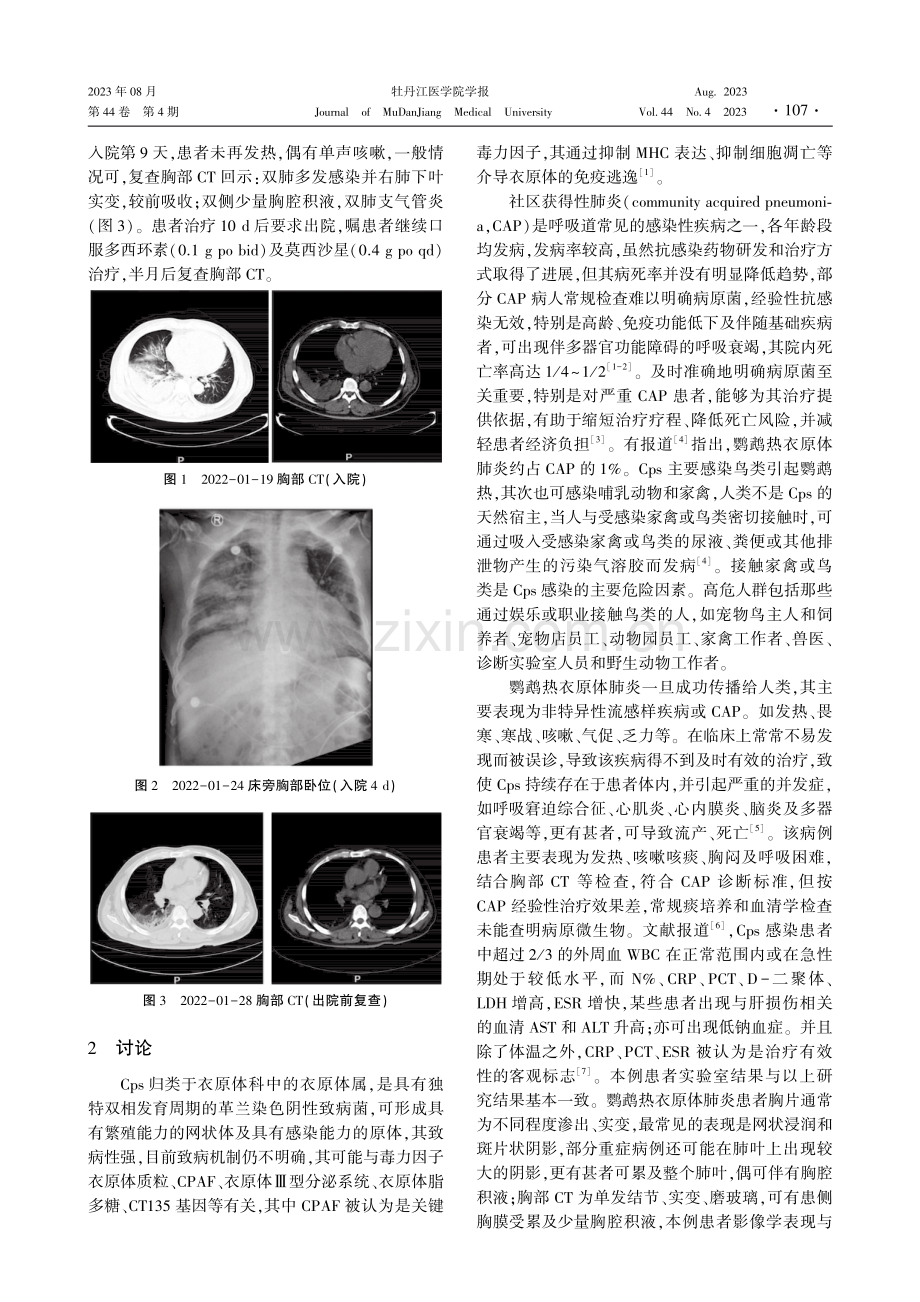 通过mNGS诊断鹦鹉热衣原体肺炎的救治经验并文献复习.pdf_第2页