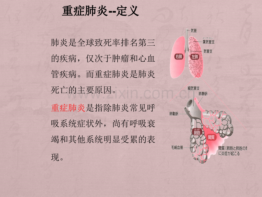 重症肺炎护理个案ppt课件.ppt_第3页