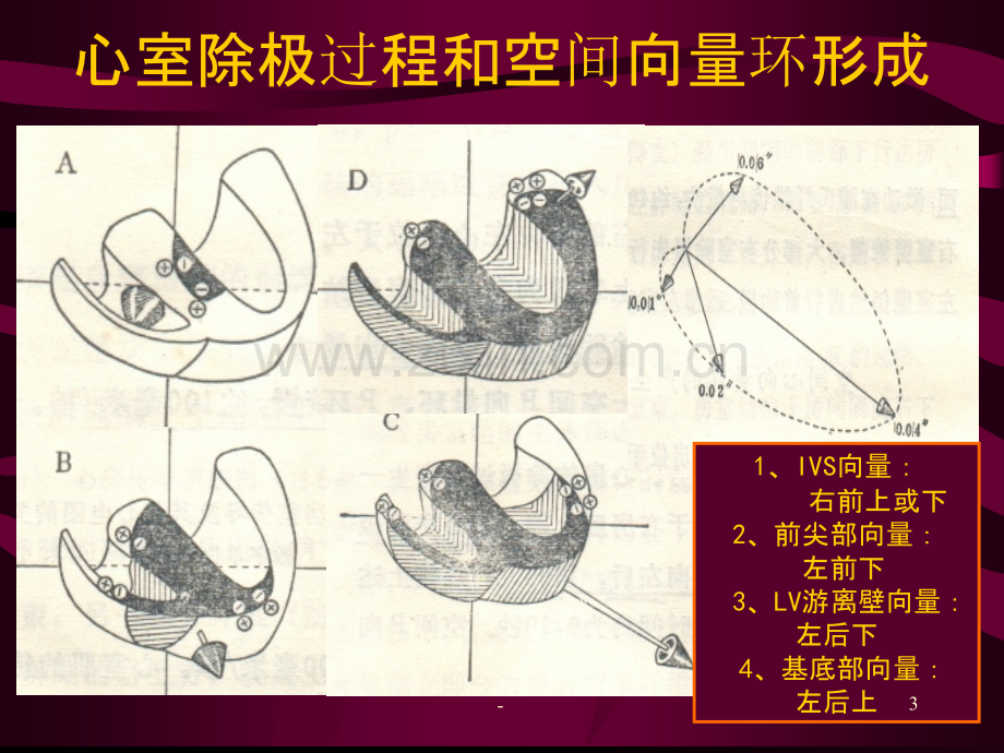 常见心电图PPT课件.ppt_第3页