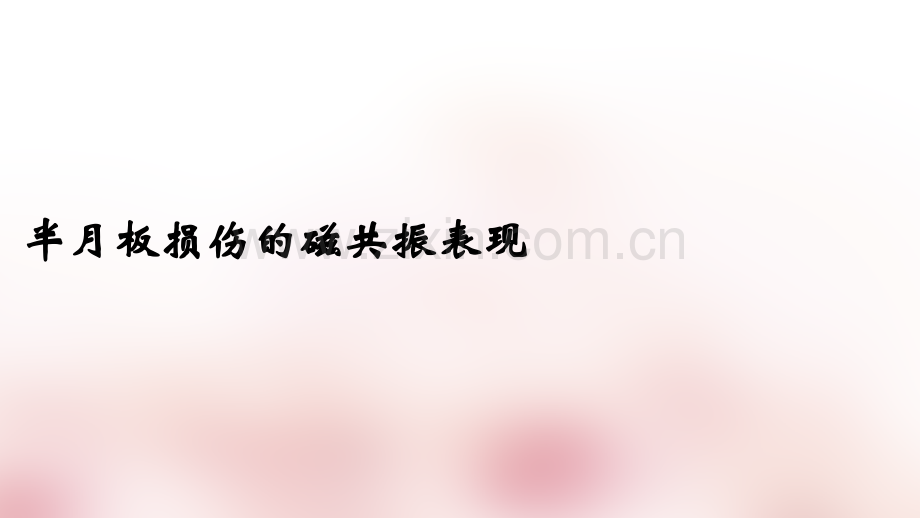 半月板损伤的磁共振表现ppt课件.ppt_第1页