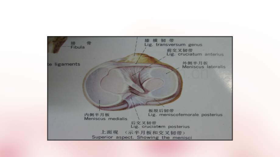 半月板损伤的磁共振表现ppt课件.ppt_第2页