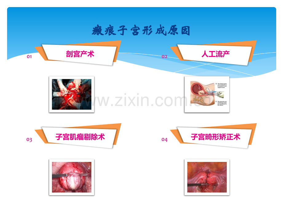 重视瘢痕子宫-预防产后出血ppt课件.pptx_第3页