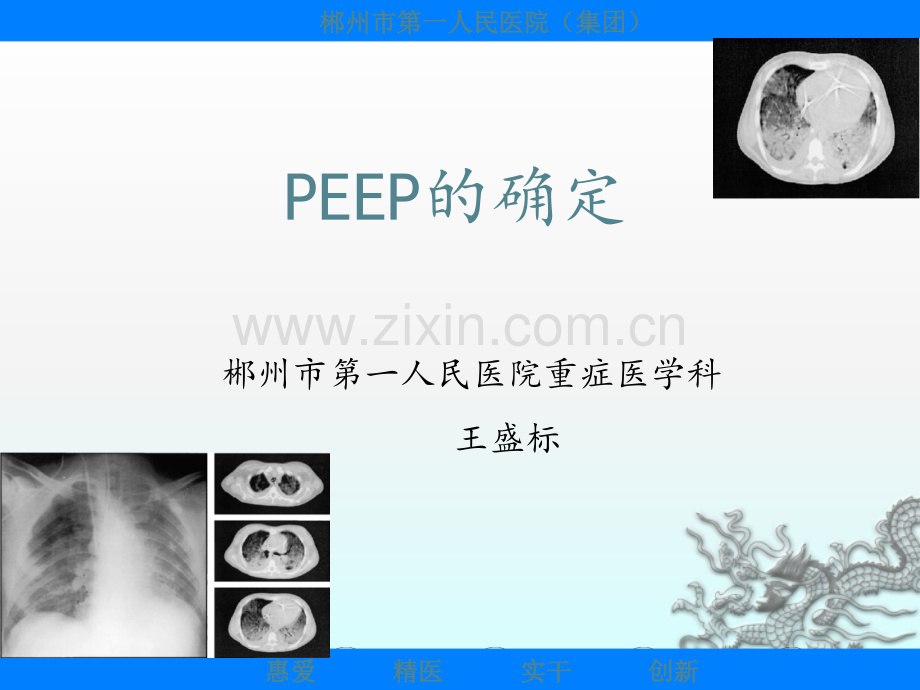 PEEP的滴定ppt课件.ppt_第1页