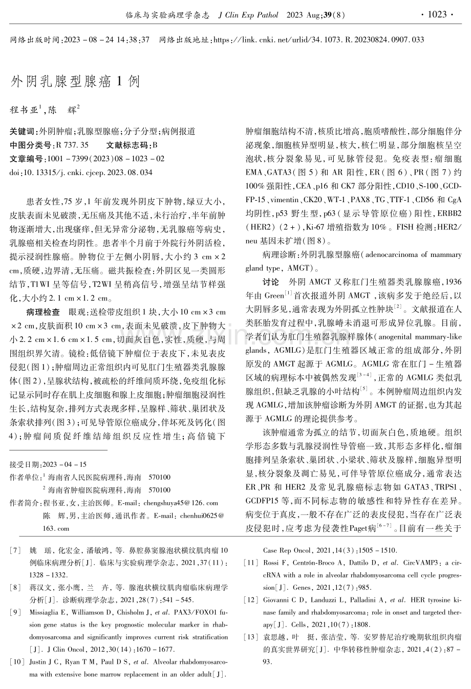 外阴乳腺型腺癌1例.pdf_第1页