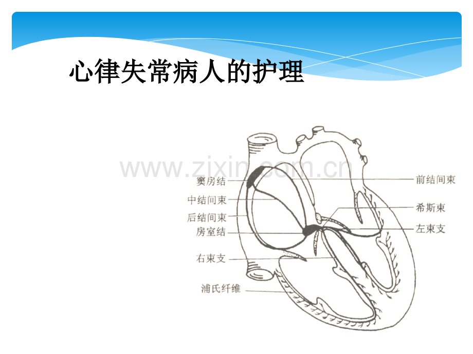 心律失常病人的护理.ppt_第1页