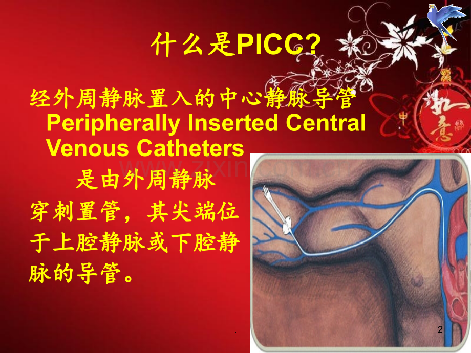 PICC常见并发症及处理护理查房PPT课件.ppt_第2页