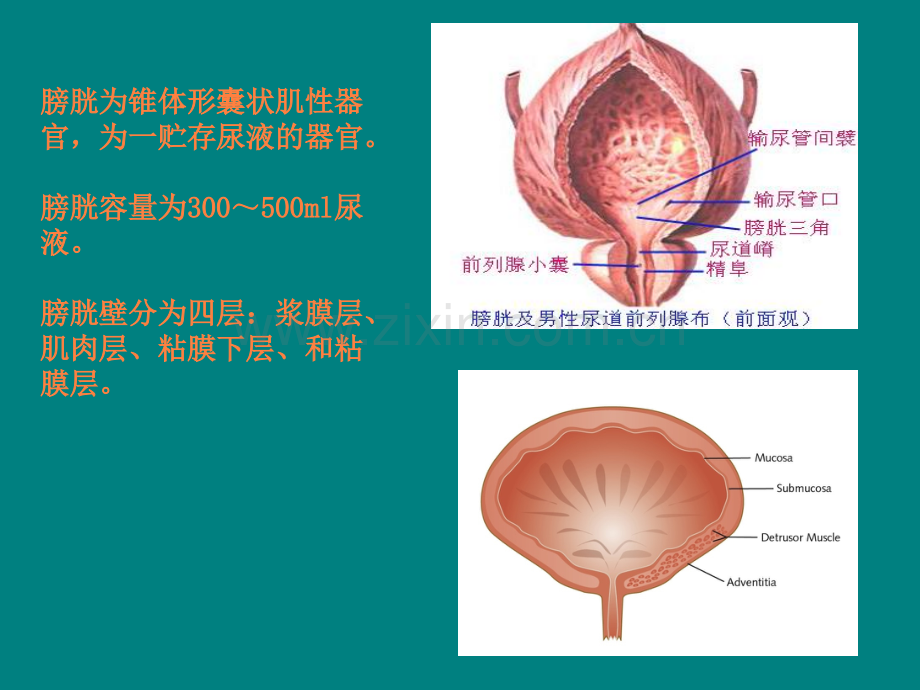 膀胱癌根治术患者的护理查房ppt课件.ppt_第3页