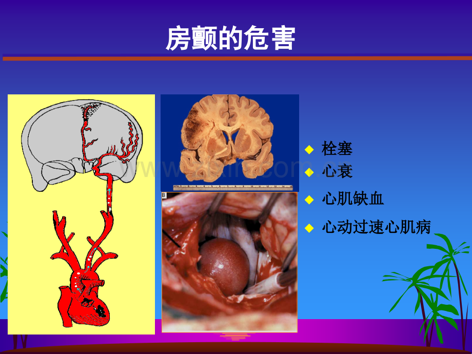 房颤抗凝的规范化治疗.ppt_第3页