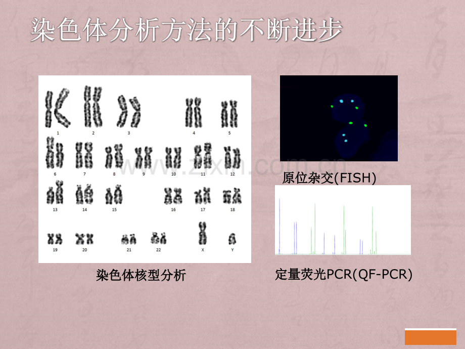 CMA在产前诊断中的应用.ppt_第3页