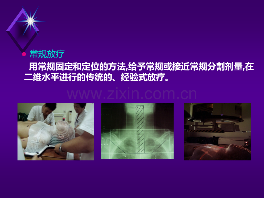 肺癌精确放疗进展PPT课件.ppt_第3页