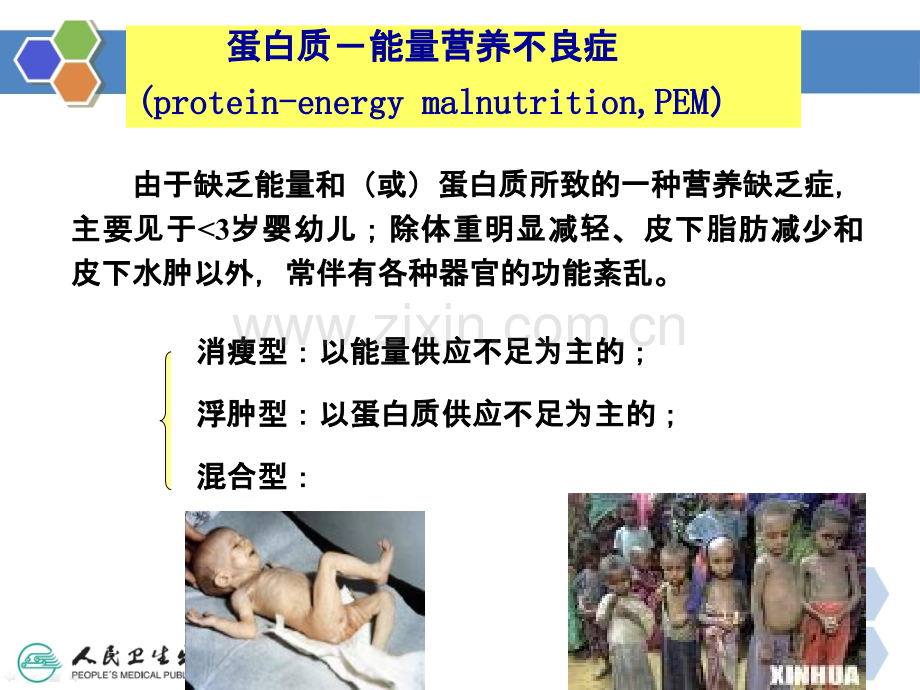 儿科疾病与营养ppt课件.ppt_第2页