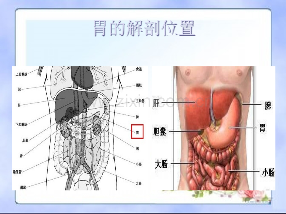 胃癌常见手术方式ppt课件.ppt_第2页