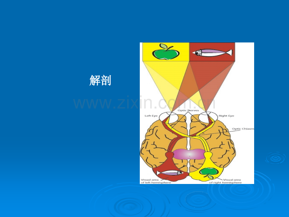 视神经肿瘤影像学表现及鉴别ppt课件.pptx_第2页