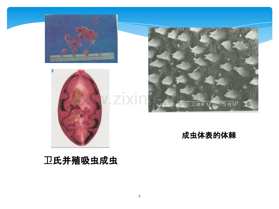 肺吸虫ppt课件.ppt_第3页