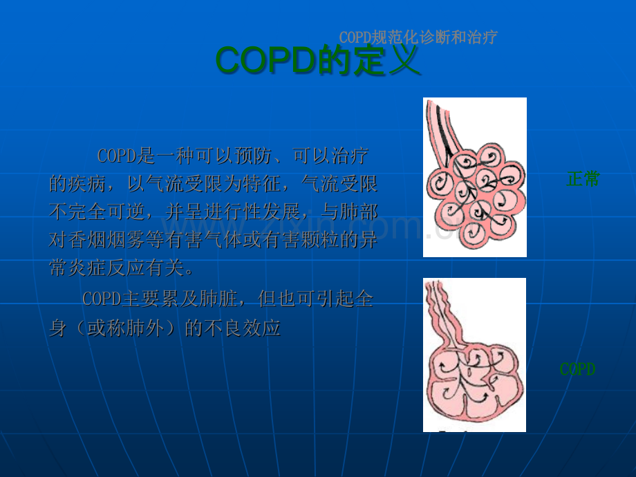 COPD的定义和发病机制.ppt_第3页