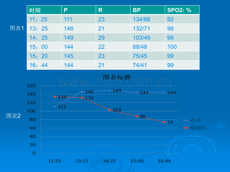 胰腺癌并发感染性休克的护理查房ppt课件.pptx_第3页