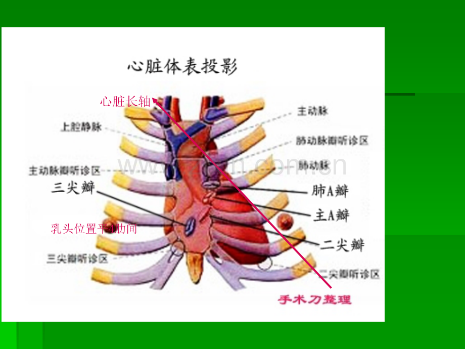 超声心动图常用切面的打法图解ppt课件.ppt_第3页