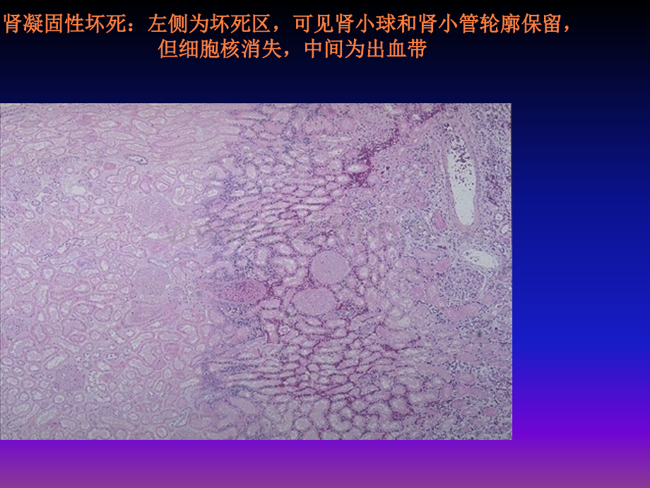 病理学实验切片考试题图集ppt课件.ppt_第3页