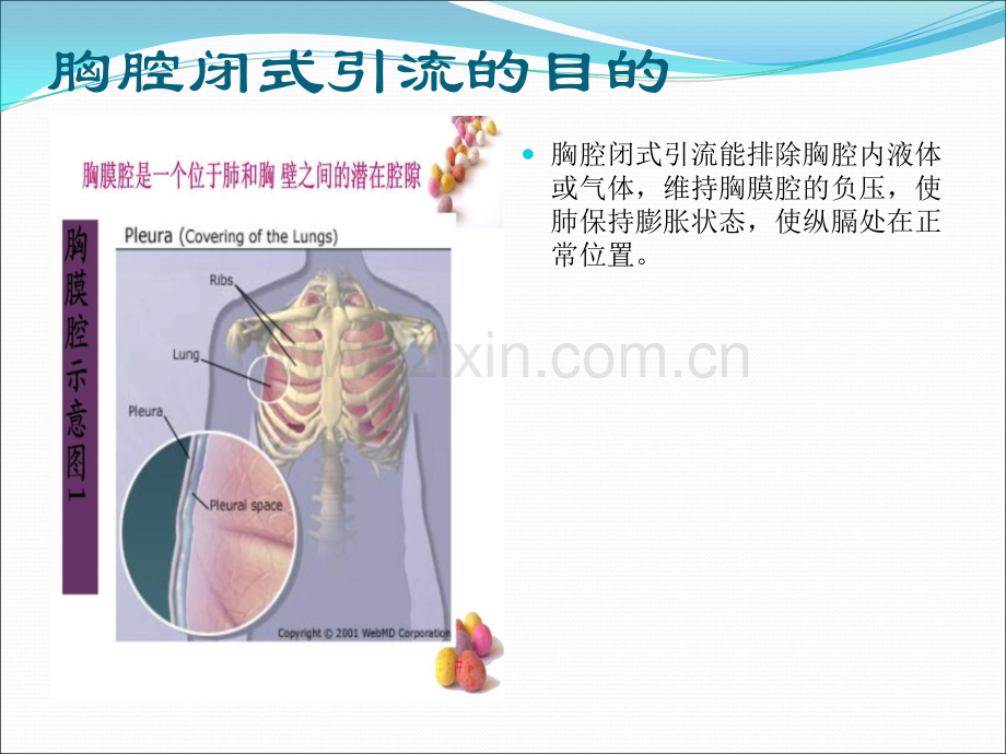 胸腔闭式引流的护理及注意事项.ppt_第3页