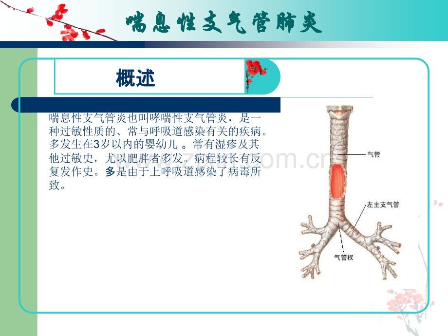 小儿支气管肺炎的护理查房ppt课件.ppt_第2页