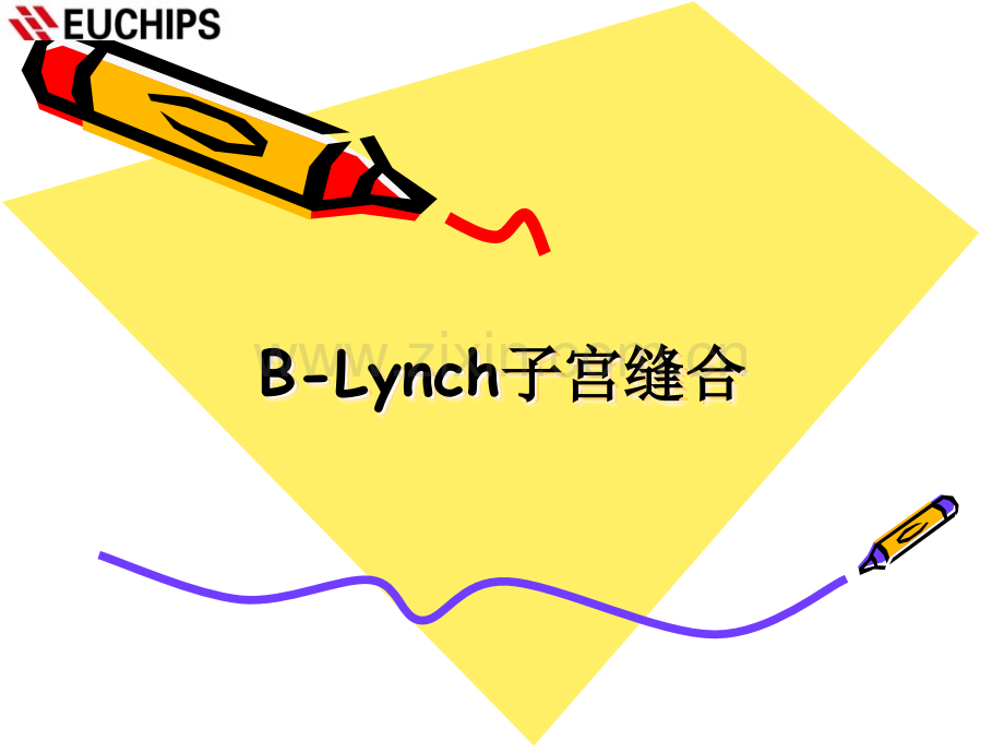 B-LYNCH缝合术.ppt_第1页