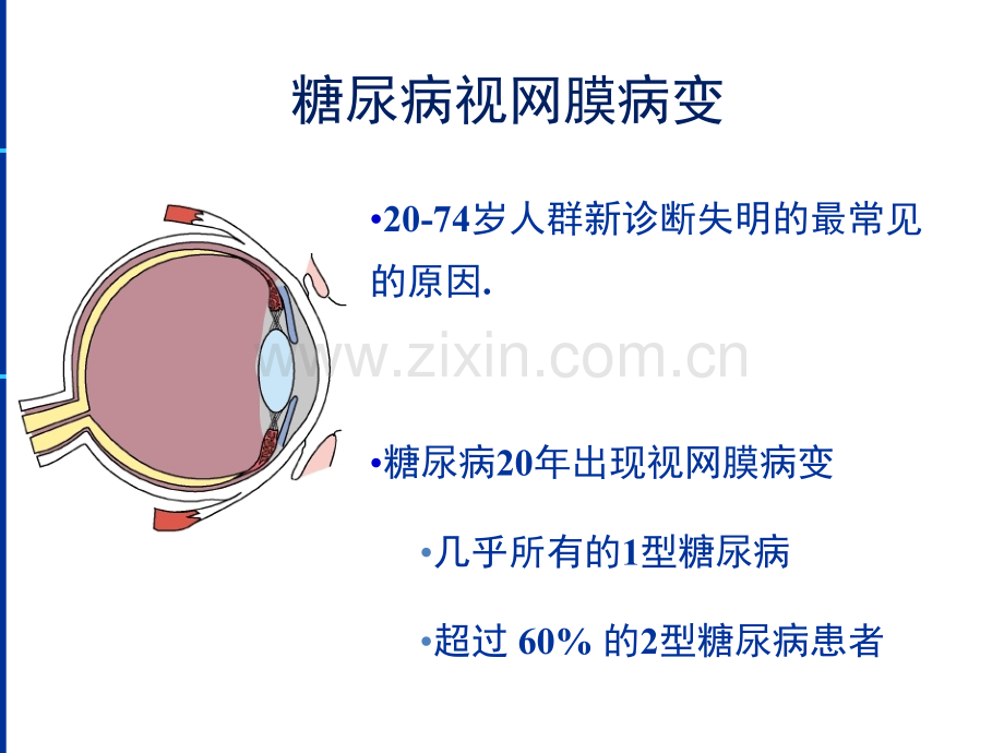 MSD糖尿病视网膜病变PPT课件.ppt_第1页