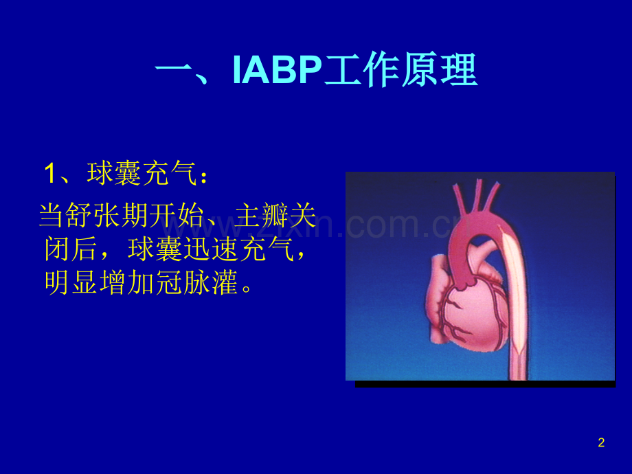 IABP使用常见问题.ppt_第2页