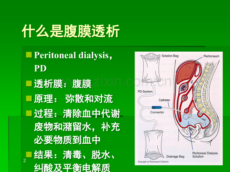 腹膜透析的原理和应用ppt课件.ppt_第2页