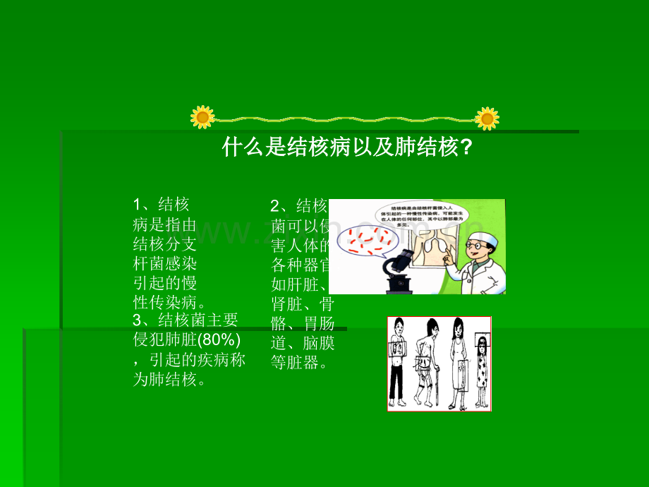 学生结核病防治知识宣传(中学).ppt_第3页