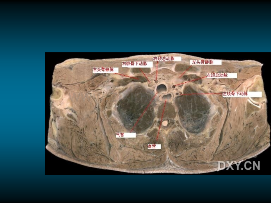 肺部正常CT.ppt_第2页