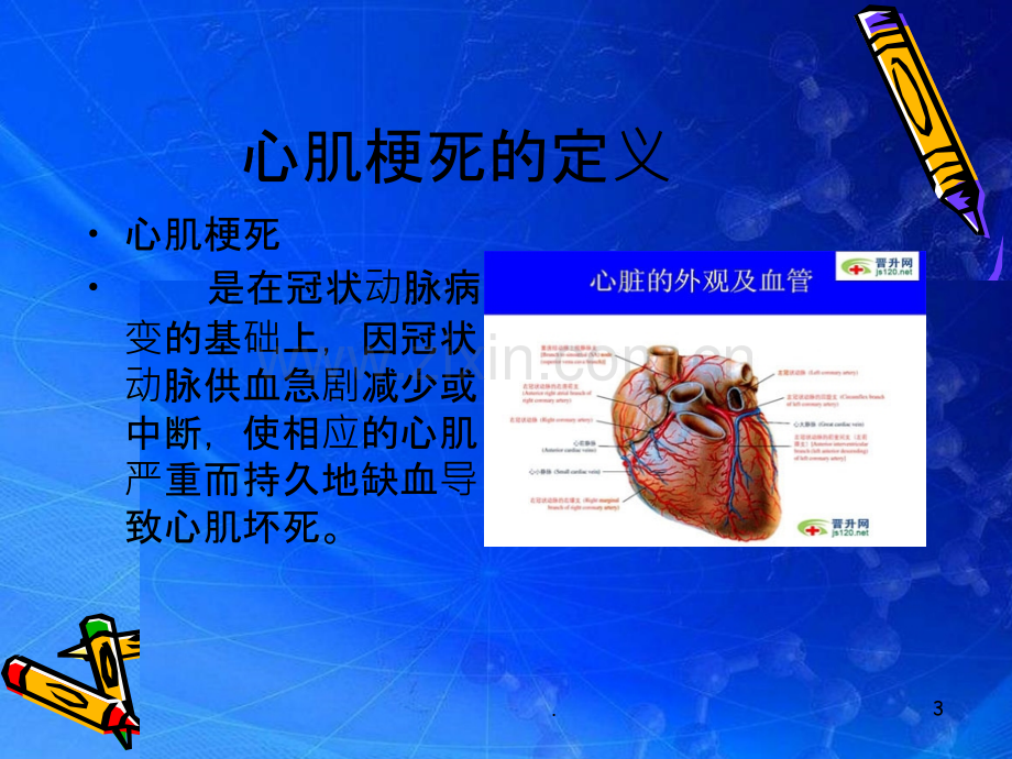 心肌梗死患者的护理.ppt_第3页