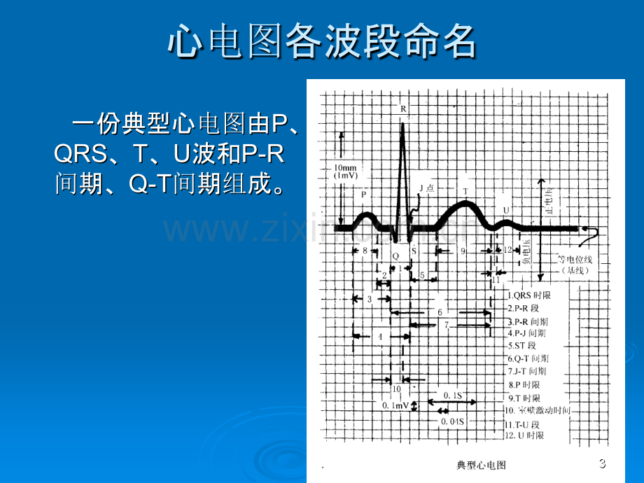 爱爱医资源心脏疾病的心电图诊断ppt课件.ppt_第3页