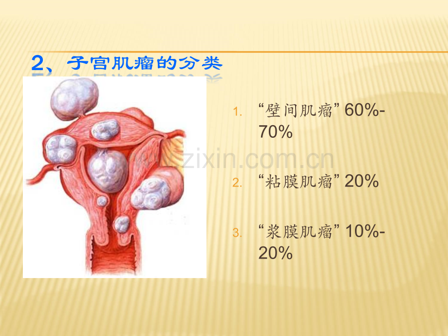 妇科肿瘤内调与防治.ppt_第3页